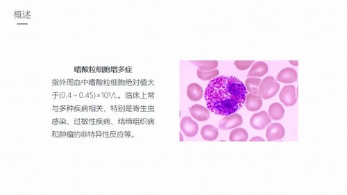 a0165 嗜酸细胞增多症的护理业务课件PPT课件27页可编辑无水印直接可用 第3页