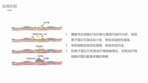 a0165 嗜酸细胞增多症的护理业务课件PPT课件27页可编辑无水印直接可用 第5页