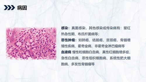a0166 嗜酸细胞增多症的护理查房知识PPT课件34页可编辑无水印直接可用 第5页