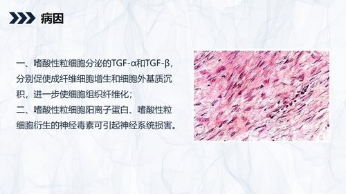 a0166 嗜酸细胞增多症的护理查房知识PPT课件34页可编辑无水印直接可用 第6页