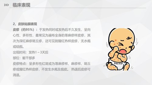 a0169 川崎病儿科护理业务知识PPT课件33页可编辑无水印直接可用 第7页