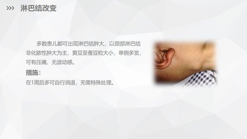 a0169 川崎病儿科护理业务知识PPT课件33页可编辑无水印直接可用 第14页