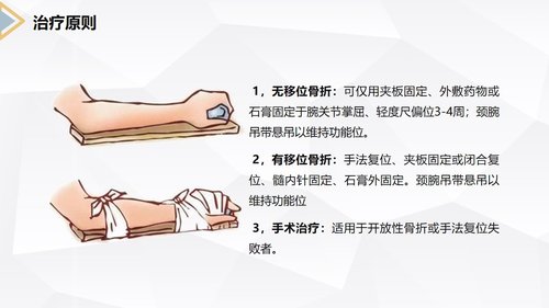 a0171 左桡尺骨双骨折的护理查房PPT课件24页可编辑无水印直接可用 第12页