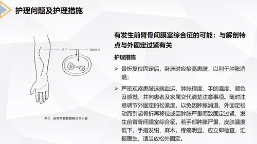 a0171 左桡尺骨双骨折的护理查房PPT课件24页可编辑无水印直接可用 第15页