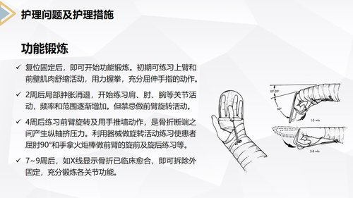 a0171 左桡尺骨双骨折的护理查房PPT课件24页可编辑无水印直接可用 第20页