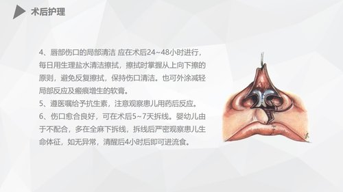 a0173 幼儿唇裂的护理查房PPT课件38页可编辑无水印直接可用 第14页
