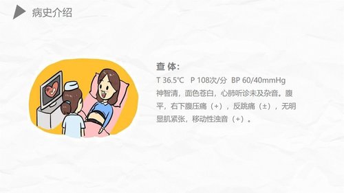a0174 异位妊娠护理PPT课件27页可编辑无水印直接可用 第4页