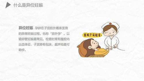 a0174 异位妊娠护理PPT课件27页可编辑无水印直接可用 第9页