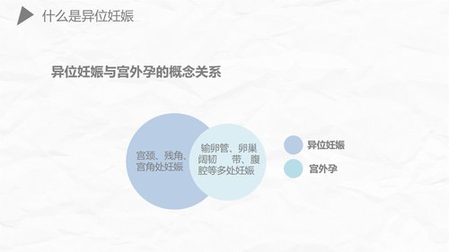 a0174 异位妊娠护理PPT课件27页可编辑无水印直接可用 第10页