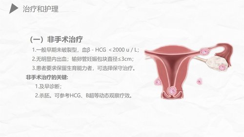 a0174 异位妊娠护理PPT课件27页可编辑无水印直接可用 第17页