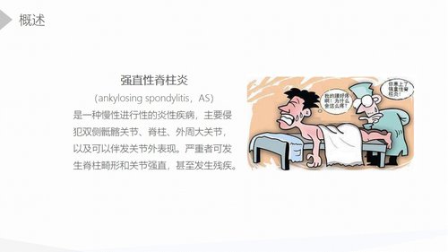 a0175 强直性脊柱炎的护理查房PPT课件45页可编辑无水印直接可用 第3页