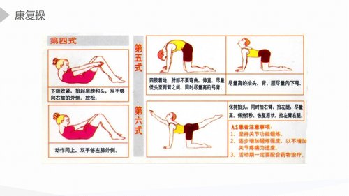 a0175 强直性脊柱炎的护理查房PPT课件45页可编辑无水印直接可用 第19页