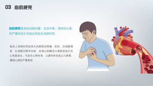 a0177 急性心梗护理查房PPT课件24页可编辑无水印直接可用 第11页