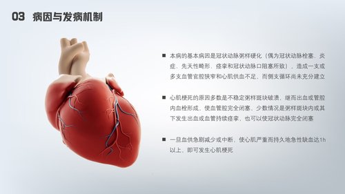 a0177 急性心梗护理查房PPT课件24页可编辑无水印直接可用 第13页