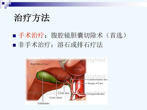 a0179 急腹症护理查房PPT课件56页可编辑无水印直接可用 第8页