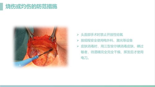 a0183 手术室的护理安全管理课件PPT课件41页可编辑无水印直接可用 第6页