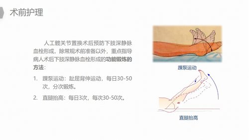 a0187 换人工髋关节预防深静脉血栓护理PPT课件22页可编辑无水印直接可用 第14页