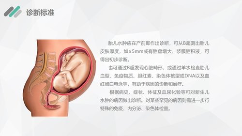 a0189 新生儿水肿的护理查房PPT课件29页可编辑无水印直接可用 第7页