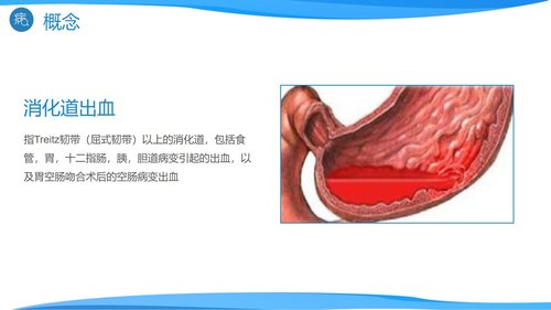 a0193 消化道出血医疗PPTPPT课件27页可编辑无水印直接可用 第3页
