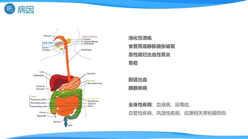 a0193 消化道出血医疗PPTPPT课件27页可编辑无水印直接可用 第5页