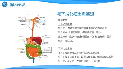 a0193 消化道出血医疗PPTPPT课件27页可编辑无水印直接可用 第7页