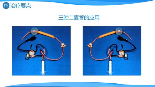 a0193 消化道出血医疗PPTPPT课件27页可编辑无水印直接可用 第11页