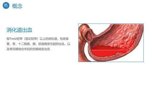 a0195 消化道出血护理PPT课件27页可编辑无水印直接可用 第4页
