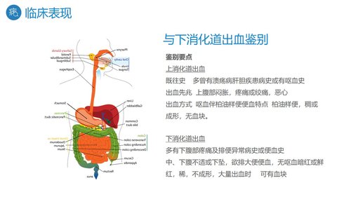 a0195 消化道出血护理PPT课件27页可编辑无水印直接可用 第8页