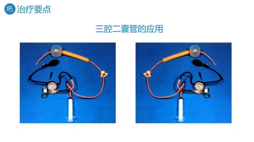 a0195 消化道出血护理PPT课件27页可编辑无水印直接可用 第13页