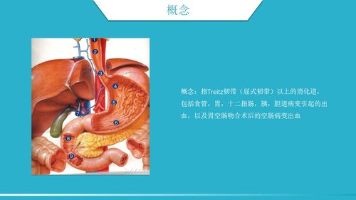 a0196 消化道出血护理2PPT课件28页可编辑无水印直接可用 第3页