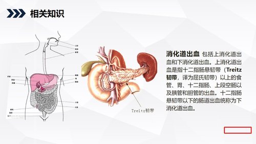 a0197 消化道出血护理查房PPT课件35页可编辑无水印直接可用 第18页