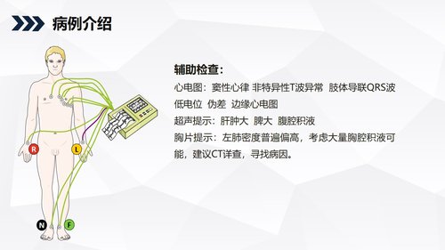 a0198 消化道出血护理查房知识教学PPT课件35页可编辑无水印直接可用 第5页