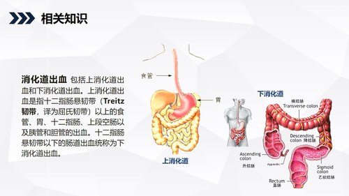 a0198 消化道出血护理查房知识教学PPT课件35页可编辑无水印直接可用 第18页