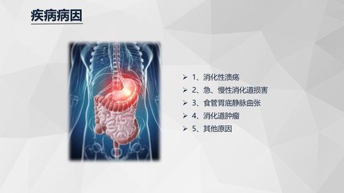 a0199 消化道大出血急救与护理知识课件PPT课件23页可编辑无水印直接可用 第4页