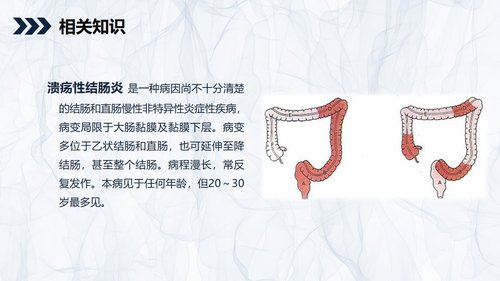 a0200 溃疡性结肠炎护理查房PPT课件27页可编辑无水印直接可用 第4页