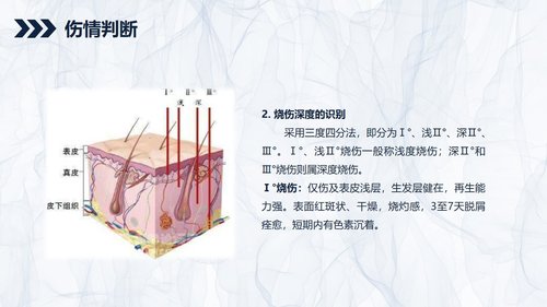 a0201 烧伤患者护理查房PPT课件44页可编辑无水印直接可用 第2页