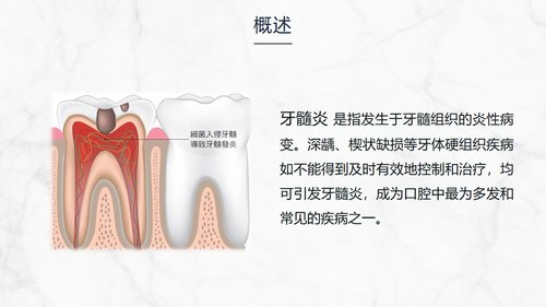 a0202 牙髓炎患者的护理查房知识课件PPT课件32页可编辑无水印直接可用 第2页