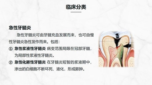 a0202 牙髓炎患者的护理查房知识课件PPT课件32页可编辑无水印直接可用 第3页