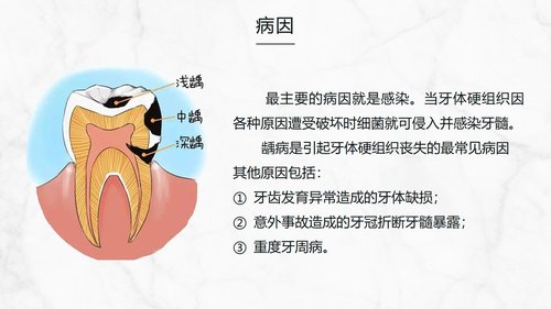 a0202 牙髓炎患者的护理查房知识课件PPT课件32页可编辑无水印直接可用 第5页