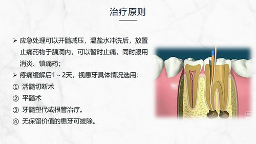 a0202 牙髓炎患者的护理查房知识课件PPT课件32页可编辑无水印直接可用 第7页
