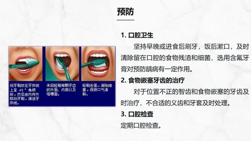 a0202 牙髓炎患者的护理查房知识课件PPT课件32页可编辑无水印直接可用 第18页