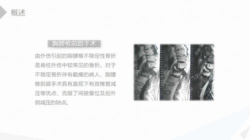 a0208 经前路腰椎手术的综合护理PPT课件41页可编辑无水印直接可用 第4页