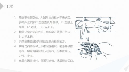 a0208 经前路腰椎手术的综合护理PPT课件41页可编辑无水印直接可用 第6页