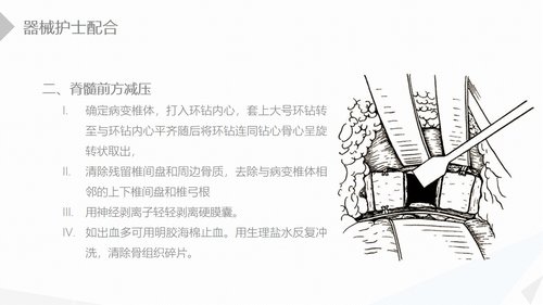 a0208 经前路腰椎手术的综合护理PPT课件41页可编辑无水印直接可用 第9页