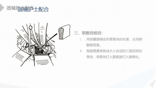 a0208 经前路腰椎手术的综合护理PPT课件41页可编辑无水印直接可用 第10页