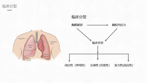 a0209 结核性胸膜炎患者自发性气胸护理PPT课件37页可编辑无水印直接可用 第4页