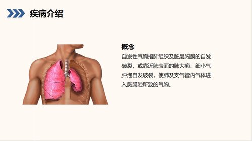 a0210 结核性胸膜炎自发性气胸护理查房PPT课件38页可编辑无水印直接可用 第4页