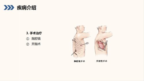 a0210 结核性胸膜炎自发性气胸护理查房PPT课件38页可编辑无水印直接可用 第9页