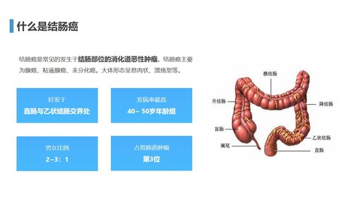 a0211 结肠癌1PPT课件30页可编辑无水印直接可用 第2页