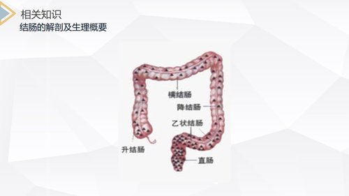 a0213 结肠癌直肠癌护理PPT课件69页可编辑无水印直接可用 第2页